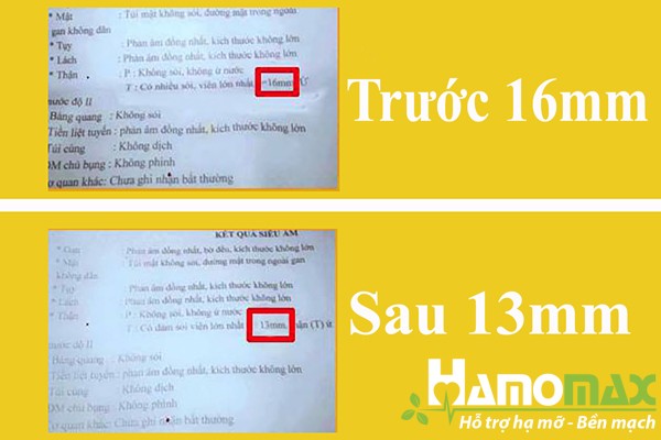 Kim Kê Đả Thạch có hiệu quả không?