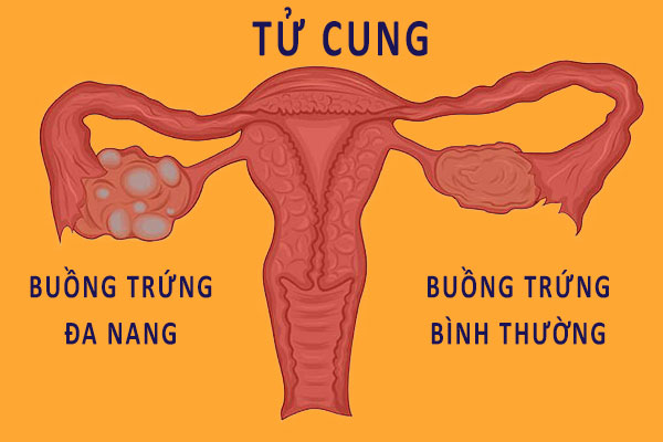 Tác dụng của thuốc tránh thai