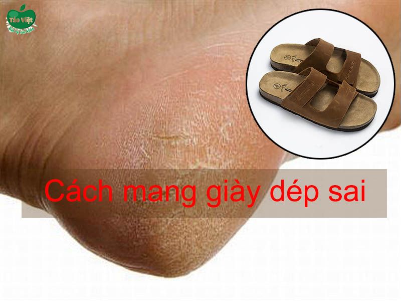 Cách mang giày dép bị sai