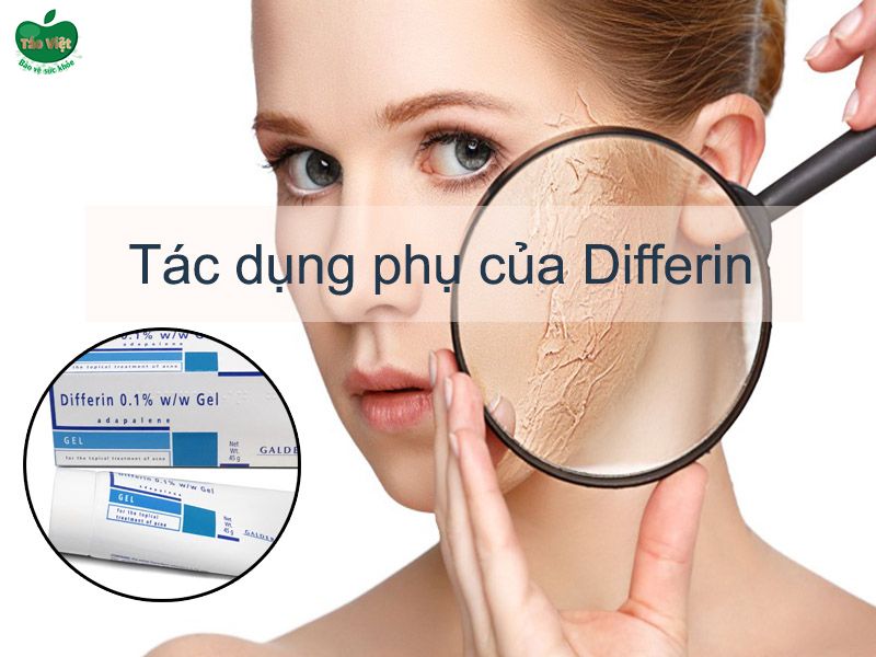 Tác dụng phụ của Differin