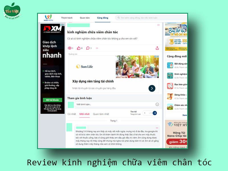 Review kinh nghiệm chữa viêm chân tóc