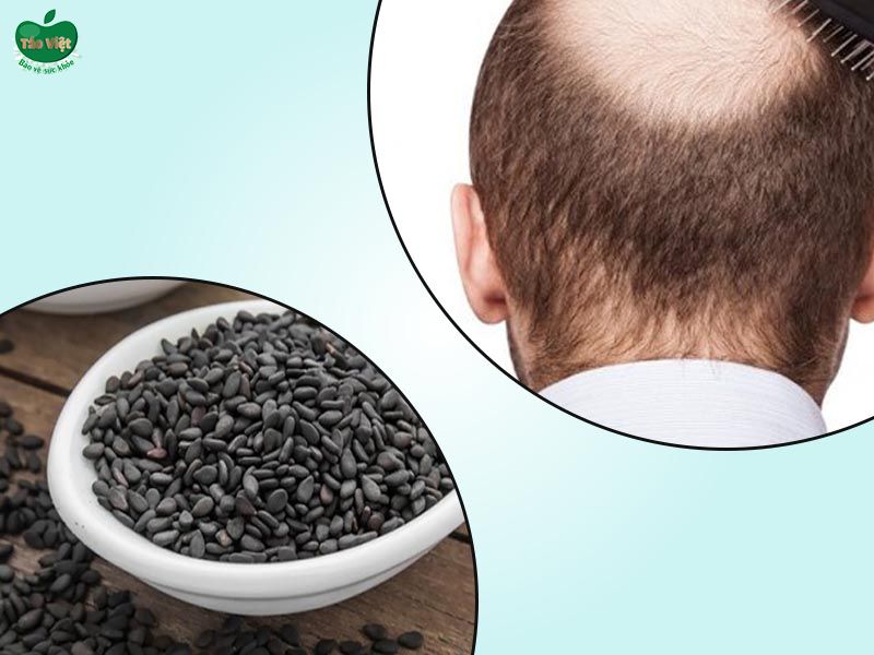 Sử dụng mè đen để điều trị rụng tóc từng mảng